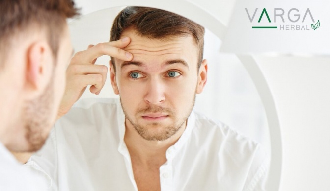 Pattanás eltüntetése - a bőrproblémák leküzdésének művészete